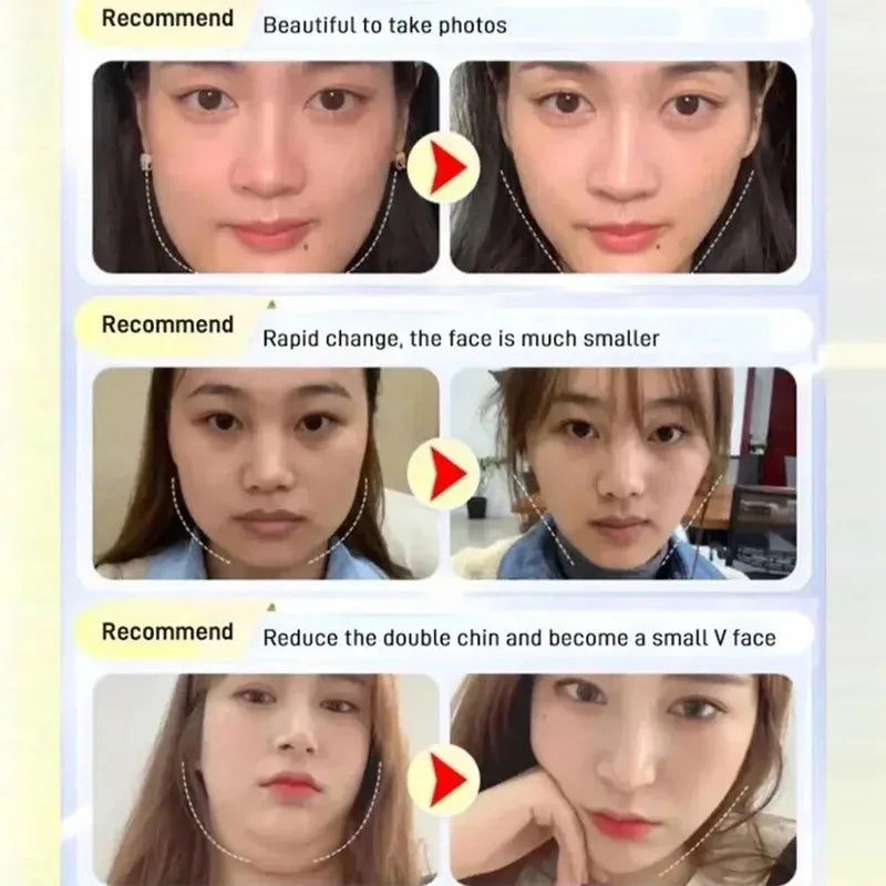 Chin & Cheek Slimming Bandage