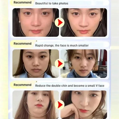 Chin & Cheek Slimming Bandage