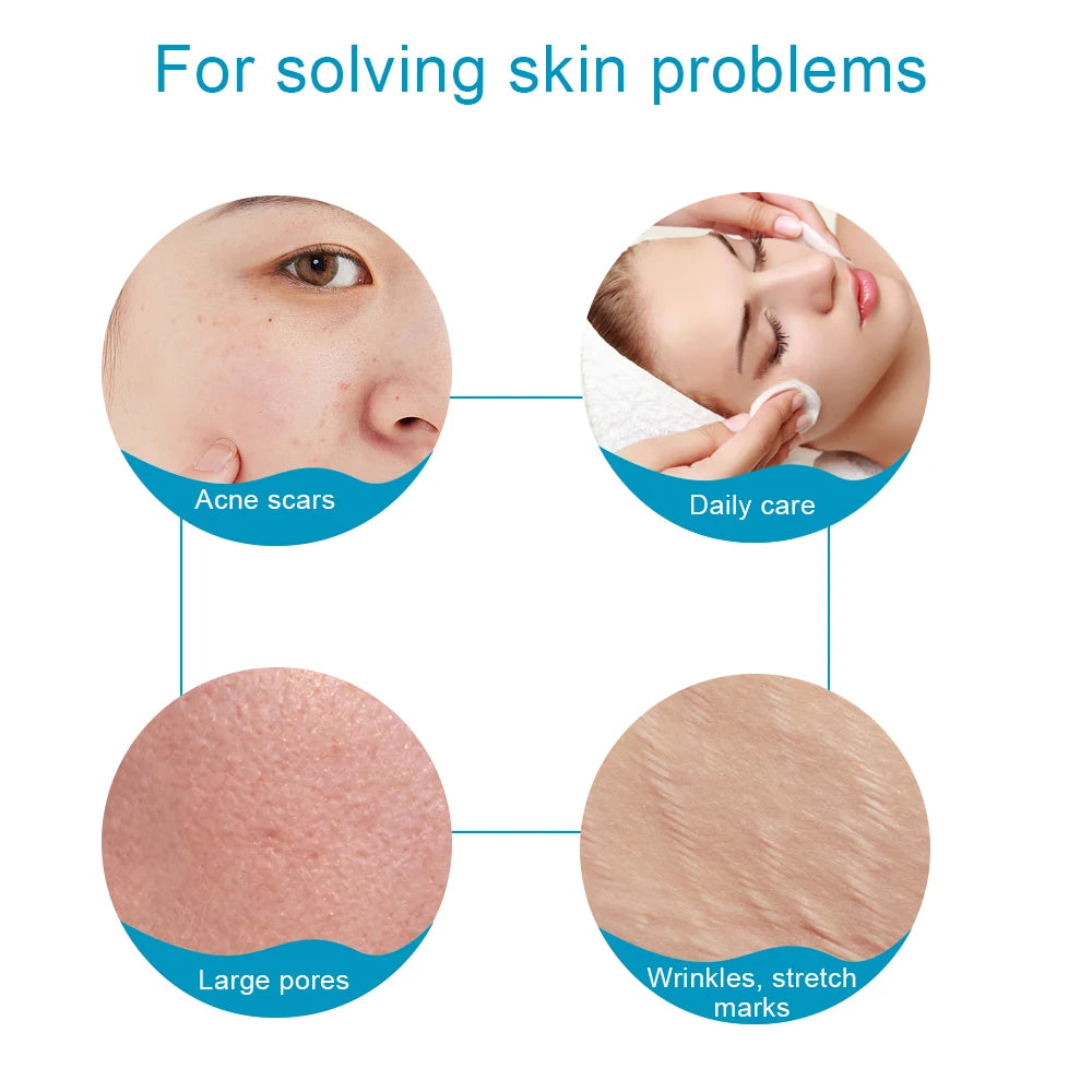 540 Micro Needle Skin & Hair Growth Beauty Tool